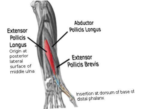 [Figure, Extensor pollicis longus Image courtesy Dr Chaigasame ...