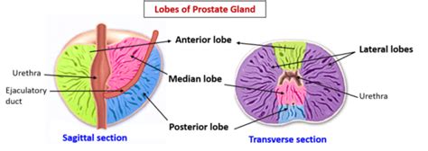 Prostate , capsules, lobes, glandular arrangement, age changes , Anatomy QA