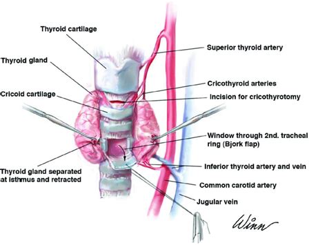 Cricothyroidotomy Anatomy