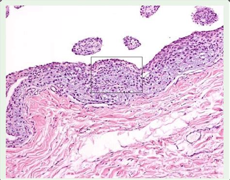 Synovial Membrane Histology