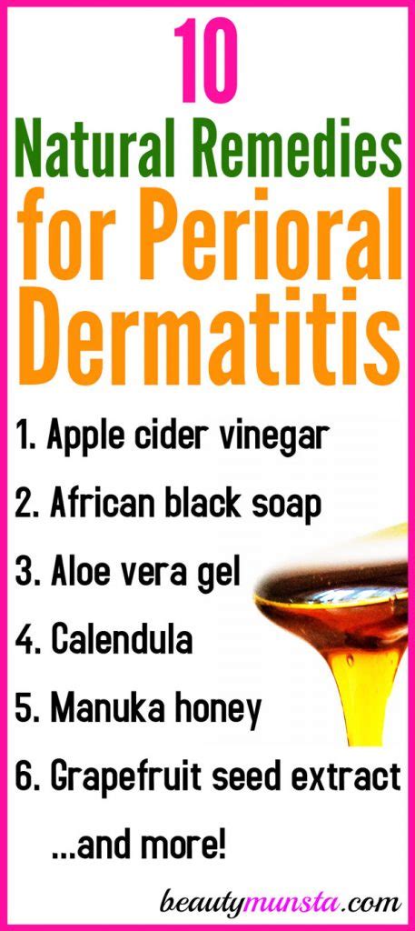 Top 10 Natural Remedies for Perioral Dermatitis (Including Recipes ...