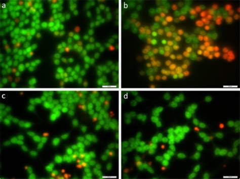 Fluorescent micrographs of acridine orange (AO, green) | Open-i