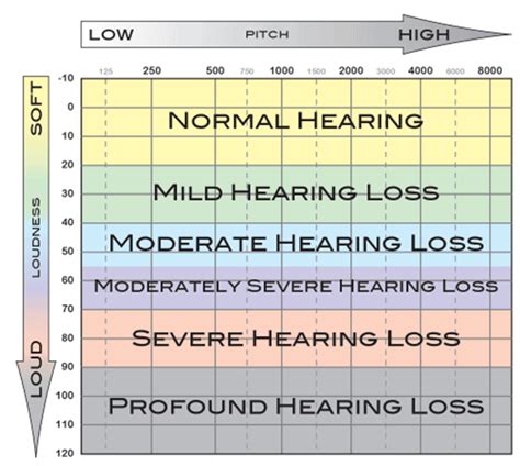 Audiogram Interpretation 101