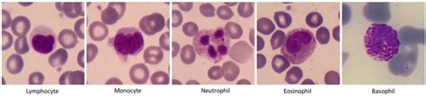 Five types of white blood cells in the normal peripheral blood ...