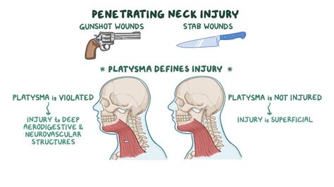 Neck trauma: Clinical: Video, Anatomy & Definition | Osmosis