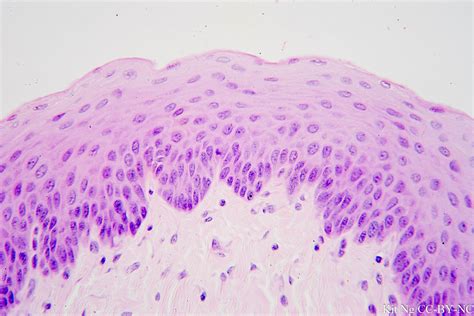 Stratified Squamous Epithelium Non Keratinized Esophagus Histology My ...