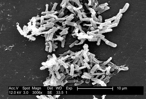 Clostridium | Bacteria, Characteristics, & Infection | Britannica