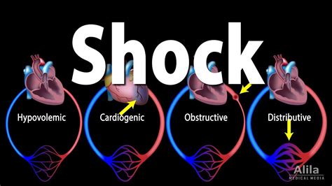 Shock, Pathology of Different Types, Animation - YouTube