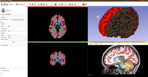 3D Slicer image computing platform | 3D Slicer