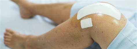 Knee Replacement Surgery for Arthritis - New Mexico Orthopaedic Associates