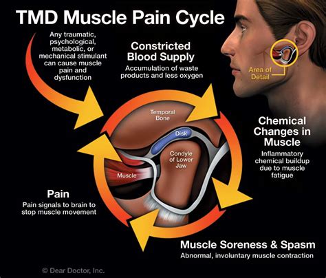 Ear And Jaw Pain On One Side Covid - SherillFione