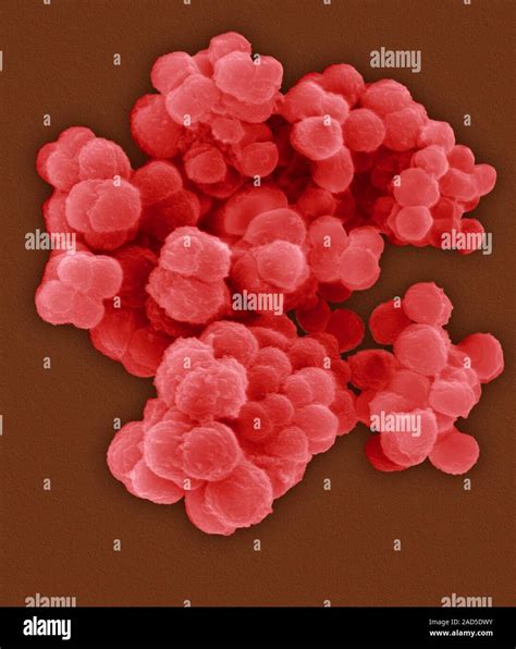 Coloured scanning electron micrograph (SEM) of Kocuria rosea, Gram ...