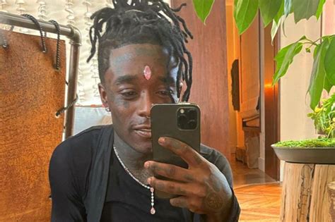 Lil Uzi Vert bids farewell to his $24M forehead diamond