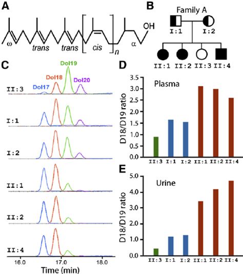 Plasma and urinary dolichol profi les of Family A. (A) Structure of ...