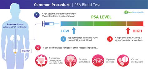 How To Lower Your PSA Level Safely And Effectively