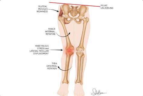 Internal Rotation Knee