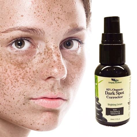 Organic Dark Spot Corrector for Age Spots & Hyperpigmentation | Skin ...