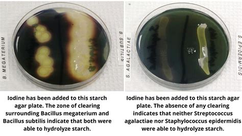 Starch Hydrolysis Test - Principle, Procedure, Results, Uses in 2022 ...