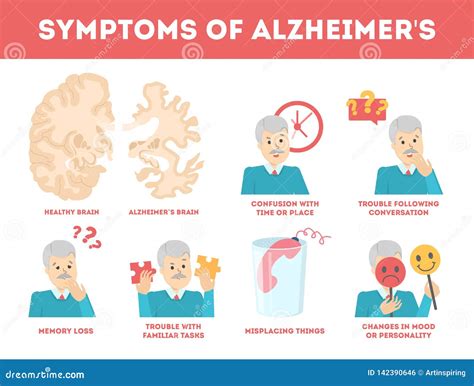 Alzheimer`s Disease. Brain And Neurons With Amyloid Plaques Cartoon ...