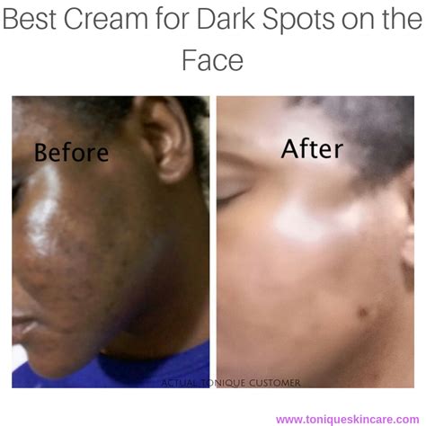 Best Cream for Dark Spots on the Face - Tonique Skincare