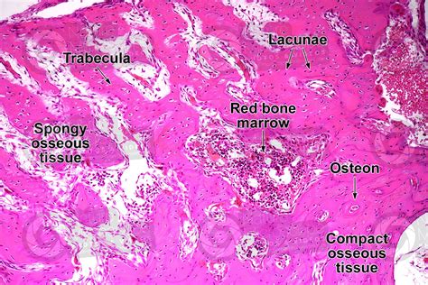 Spongy Vs Compact Bone Histology