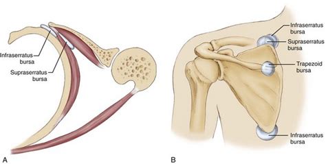 Arthroscopic and Open Management of Scapulothoracic Disorders ...