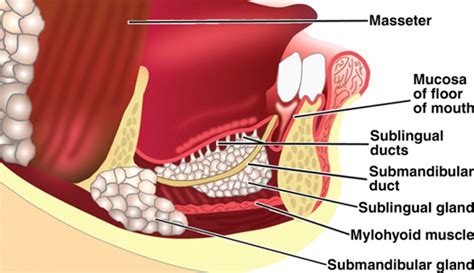 Excision of Sublingual Gland | Pocket Dentistry