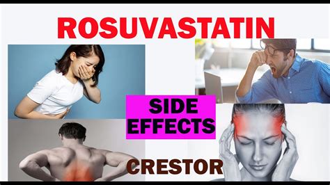 Rosuvastatin side effects/Crestor/Ezallor Sprinkle - YouTube