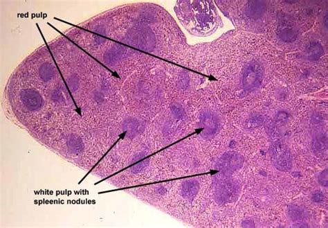 Spleen Slide Reticular