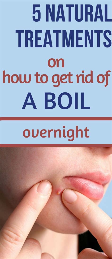 5 Natural Treatments on How To Get Rid of a Boil Overnight | How to get ...