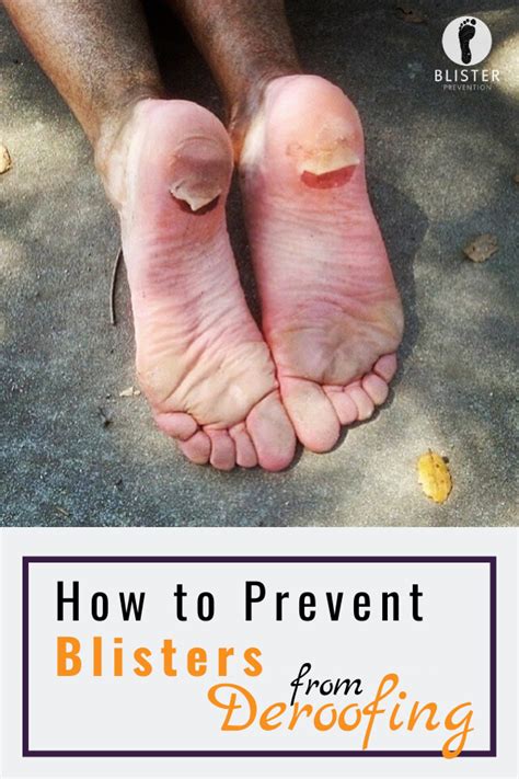 How to Prevent Blisters from Deroofing#blisters #deroofing #prevent ...