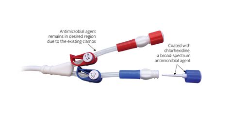 New Innovative - Central Venous Catheter Cap Reduces Risk of ...