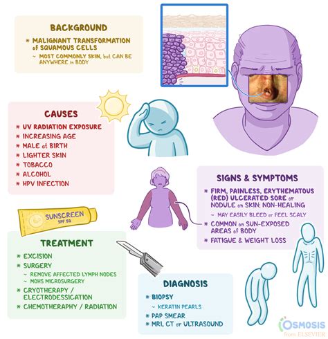 Squamous Cell Carcinoma: What Is It, Causes | Osmosis