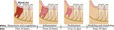 Frontiers | Pathogenesis and treatment of wound healing in patients ...