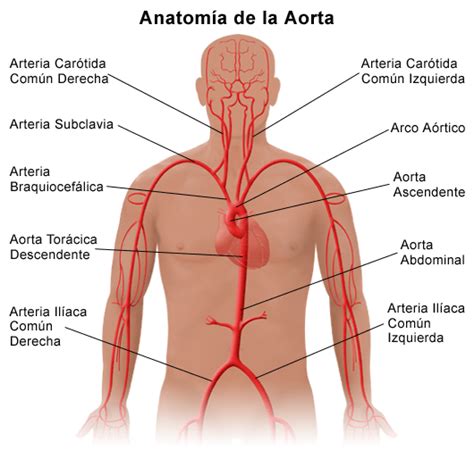 Thoracic Aortic Aneurysm and Aortic Dissection