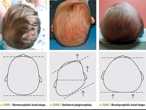 Episode 35: Does My Baby's Head Look Funny. Let's Talk about ...