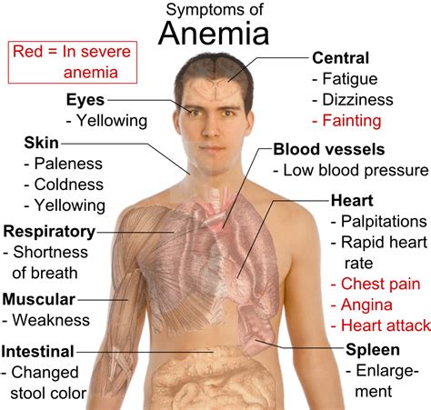 iron deficiency anemia symptoms | chemical elements