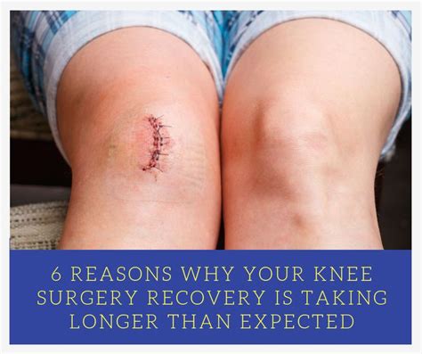 6 Reasons Why Your Knee Surgery Recovery Time Is Taking Longer | Knee ...