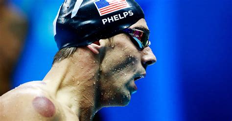 Michael Phelps Cupping Marks Details, Rio Olympics 2016