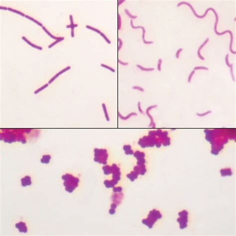 Bacterial Types Microscope Slides | Carolina.com