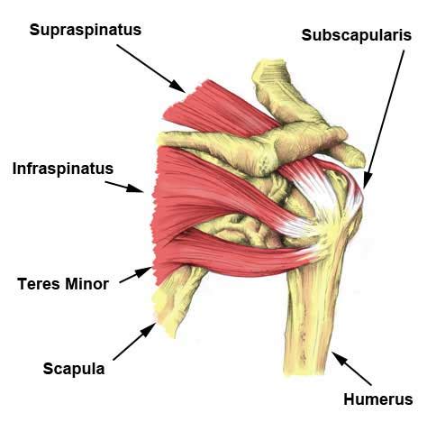 Supraspinatus Tear - Symptoms, Causes, Treatment & Rehabilitation