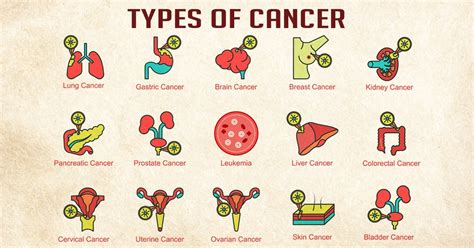 Types of Cancer Symptoms, causes, and Treatment :: Health Reactive Body ...