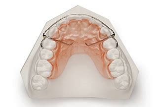 Space Maintainers, Regainers, and Bite Plates | DDS Dental Lab