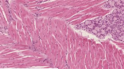 Skeletal Muscle Fiber Histology