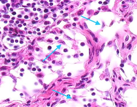 Reticular Connective Tissue Lymph Node