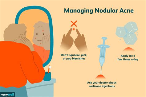 Causes de l'acné nodulaire et comment la traiter