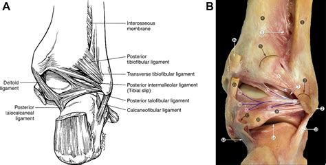 Arthroscopic Posterior Ankle Ligament Anatomy - Richard D. Ferkel, Cory ...