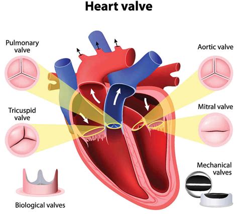 Mitral Valve And Aortic Valve