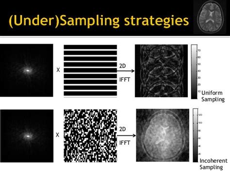 Introduction to compressed sensing MRI