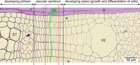 Transverse section of vascular cambium, developing xylem and phloem ...